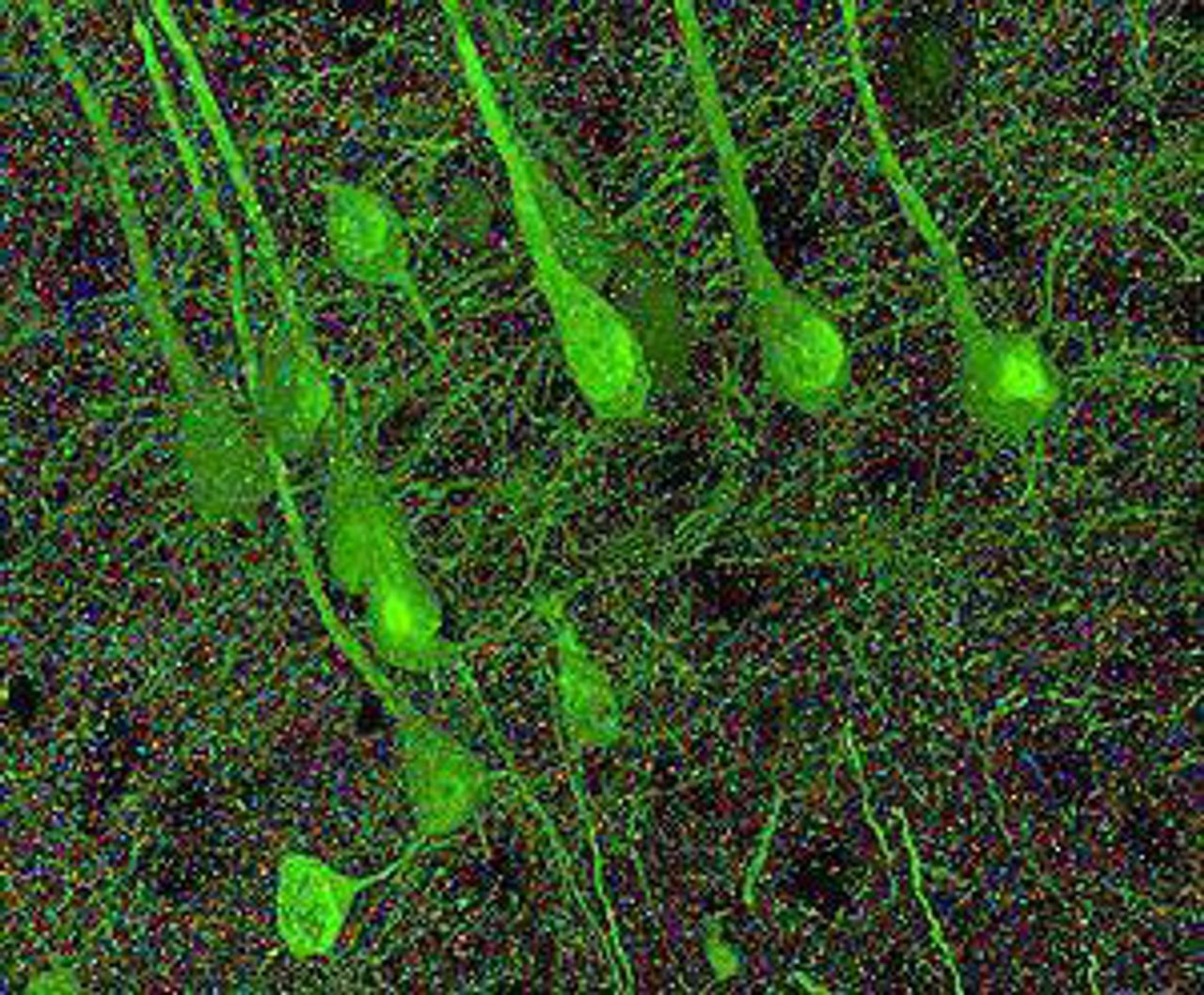 Synapses